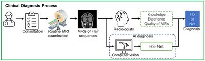 Automated detection of hippocampal sclerosis using real-world clinical MRI images